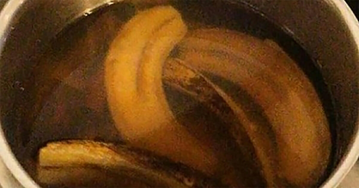 מתקשים להירדם? טריק אחד ביתי עם בננה יעזור לכם להירדם במהירות שיא