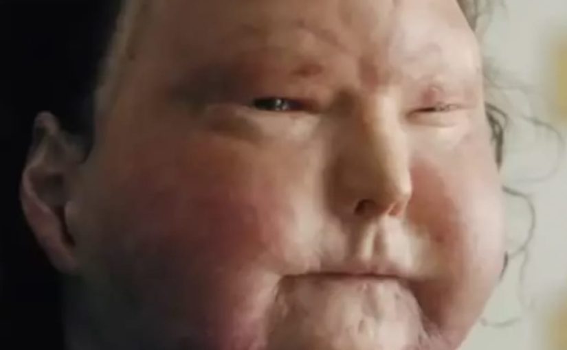 אדם שהיה בתרדמת 3 חודשים חשף מה הוא ראה ב'עולם הבא' – וזה לא מה שאתם חושבים