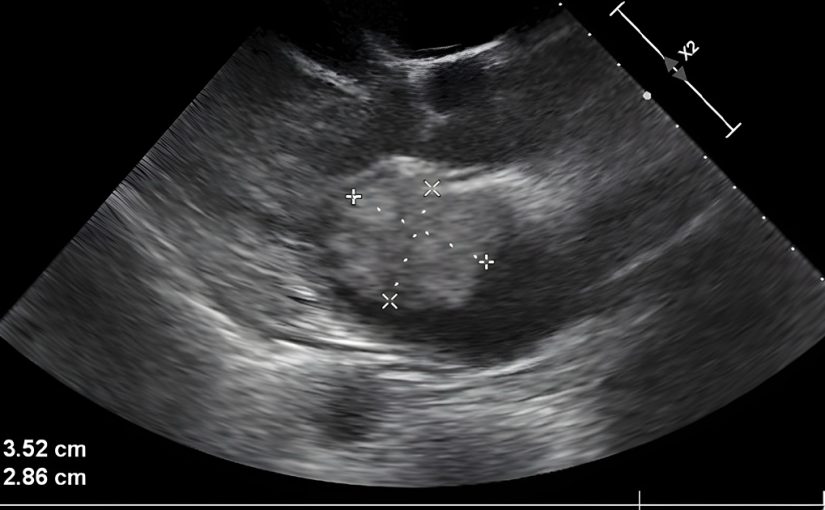 אחרי שאיבדה את בנה בטרגדיה, האם ההמומה הזו קיבלה מסר מצמרר באולטרסאונד ששינה את חייה לנצח