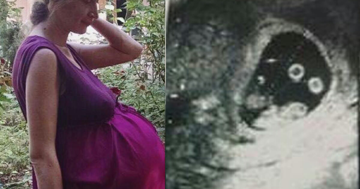 רופאים לא העזו לגעת באישה בהריון: 3 דקות אחר כך, חגיגה ענקית בחדר הלידה