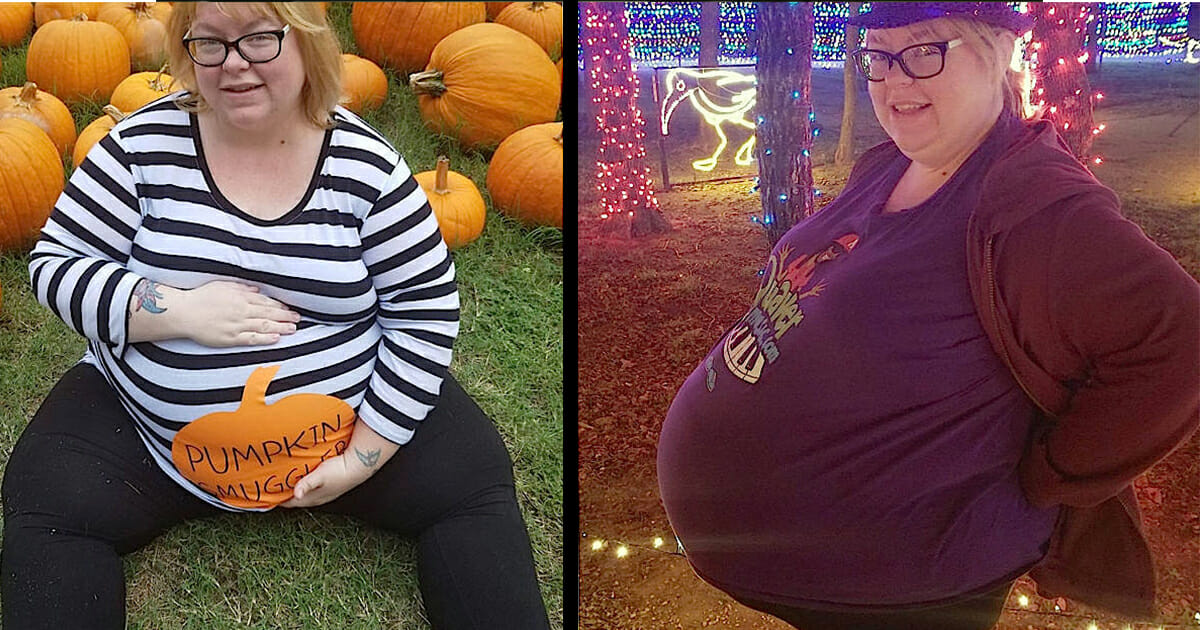 אמא ציפתה לתינוק במשקל 4.5 ק"ג – בסוף ילדה את התינוק הכי גדול שהרופאים אי פעם ראו