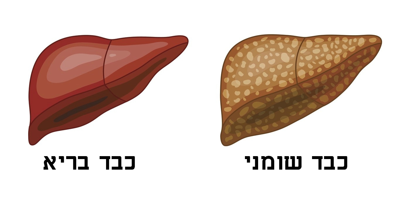 תסמינים לכבד שומני שאסור להתעלם מהם – ואיך לטפל בבעיה בצורה טבעית