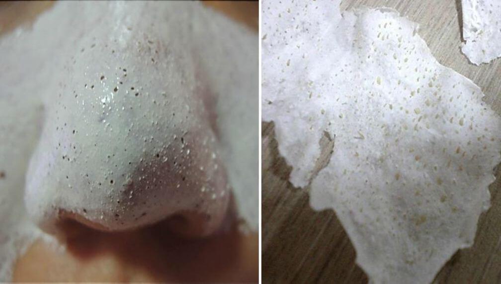 הטריק הגאוני הזה יעזור לכן להיפטר אחת ולתמיד מכל השחורים המגעילים שבפנים שלכן!