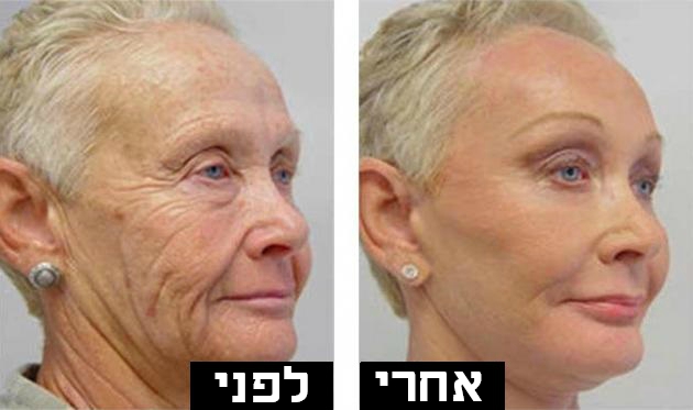 היא בת 64 וכולן מקנאות בה. אין לה קמטים והפנים שלה יפיפיות…היא סוף סוף חשפה את הסוד!