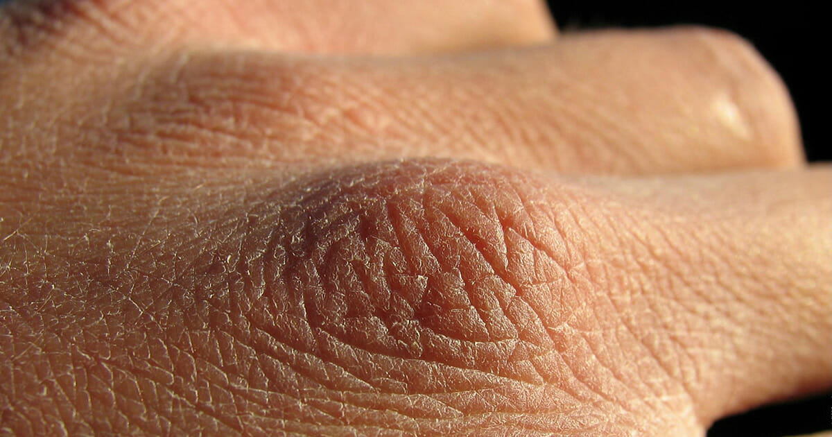 9 סימני אזהרה מהגוף שלכם שאתם לא שותים מספיק מים