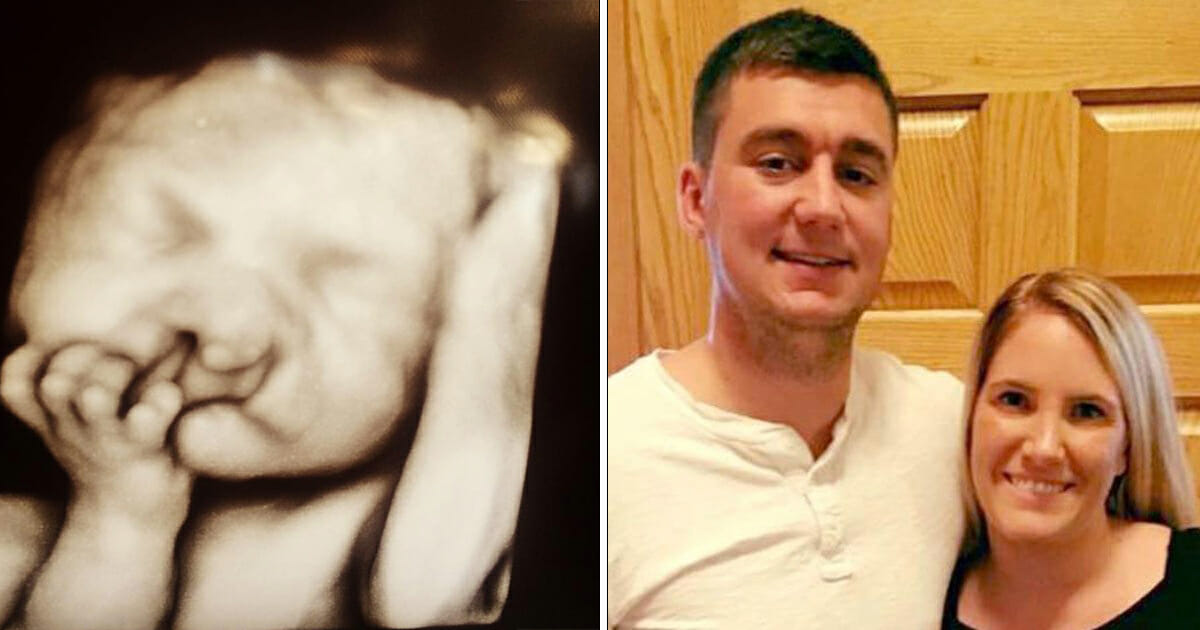 הורים סירבו לעשות הפלה לתינוק עם מום כאשר הרופאים הציעו – שנתיים אחר כך, תראו אותו עכשיו