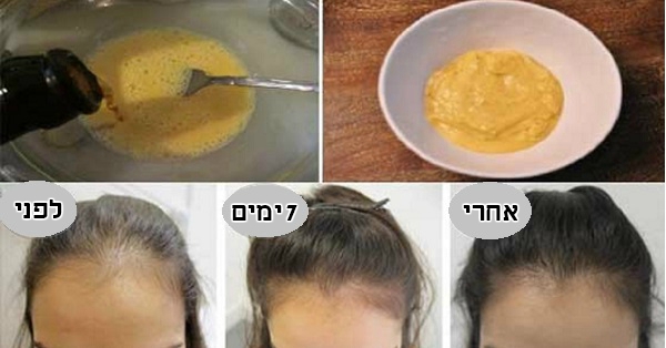במסכת השיער הזו יש רק 3 מרכיבים – היא מונעת נשירה וגורמת לצמיחה בריאה וחזקה של שיער!