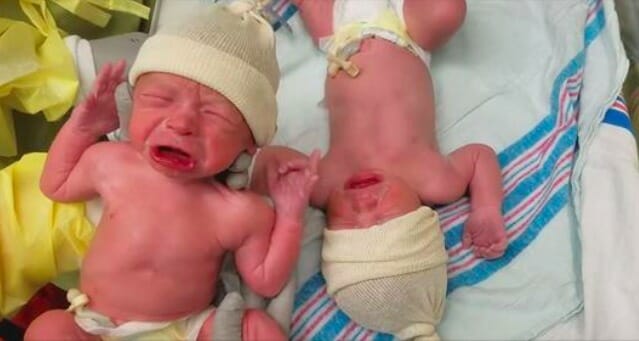 שניות אחרי הלידה, התאומים הבנים הדהימו את כולם וגרמו לאבא לרוץ להביא את המצלמה