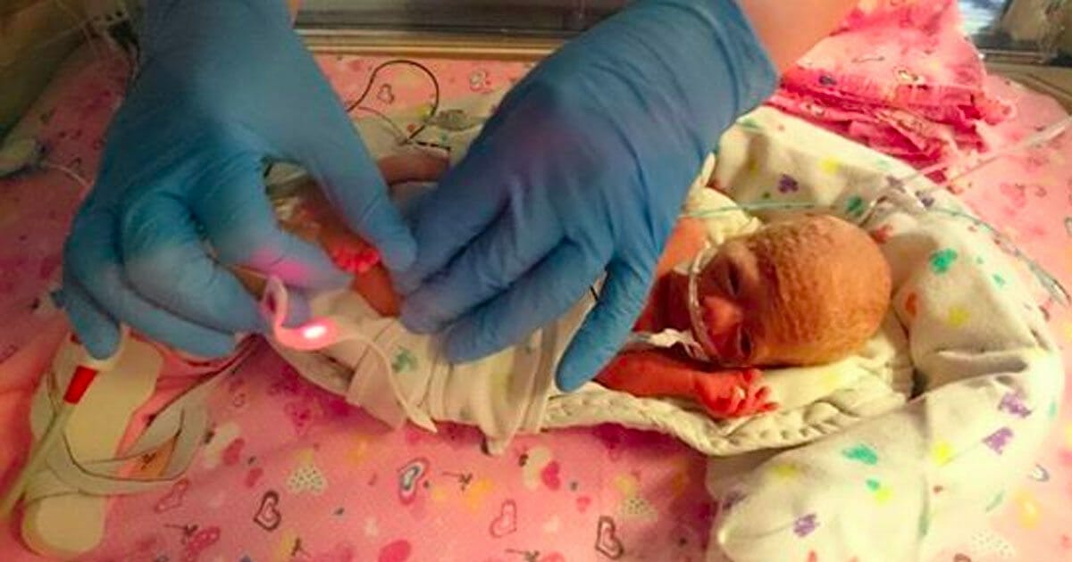 תינוקת במשקל 498 גרם הייתה שברירית וגססה – הרופאים הצילו את חייה עם שקית ניילון מהסופרמרקט