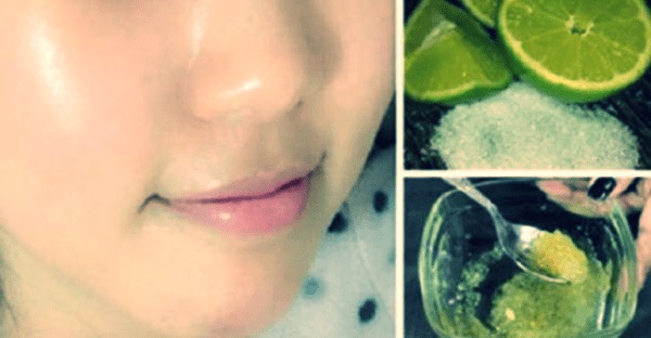 לימון הוא המרכיב הטוב ביותר שיהפוך את עור הפנים שלכן לצעיר ויעלים כתמי פיגמנטציה