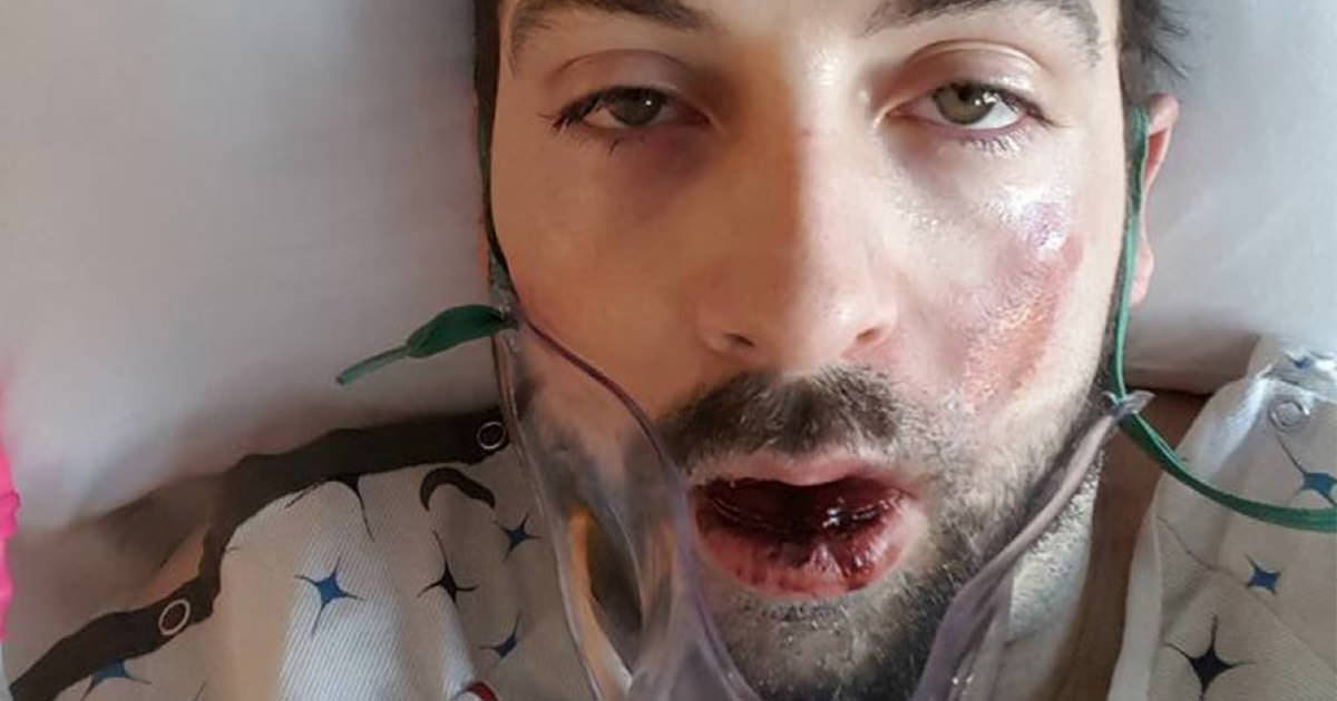 המכשיר הרגיל הזה התפוצץ בפרצוף של אבא, עכשיו הוא מזהיר את כולם!