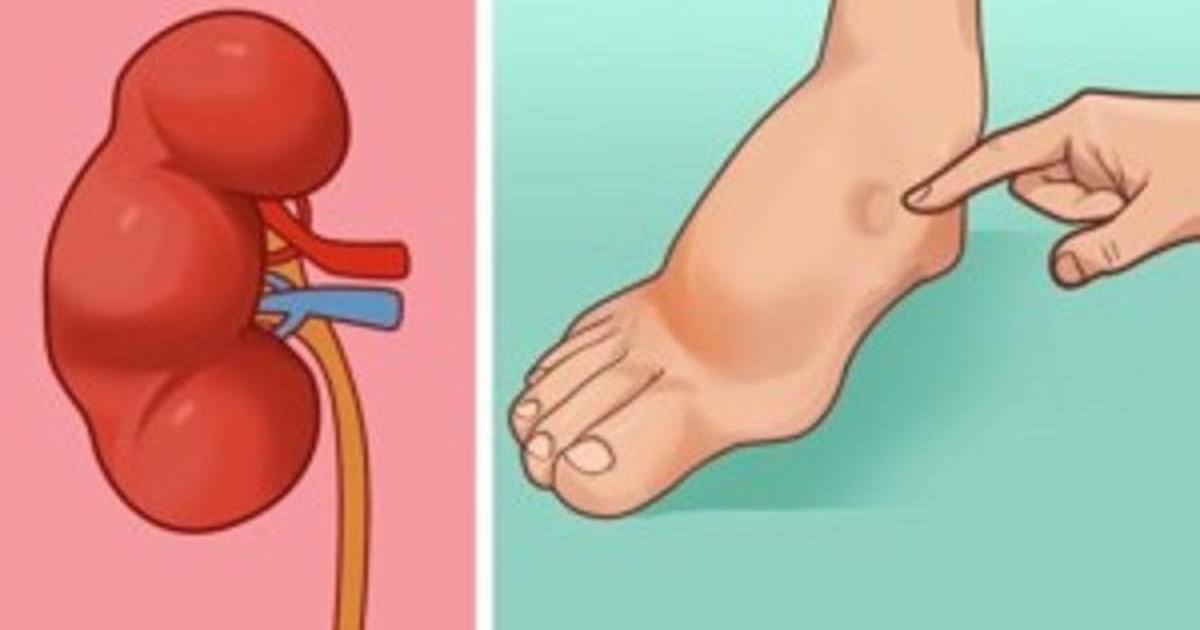 הגוף שלכם מזהיר אתכם 24 שעות לפני שבץ מוחי – הסימן החבוי שכולם צריכים להכיר