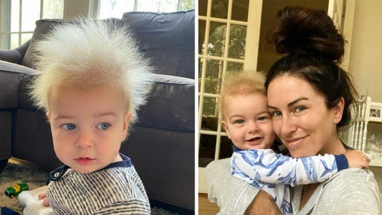 השיער הפרוע של התינוק השאיר את הרופאים בהלם – תסמונת נדירה שאף אחד כמעט ולא שמע עליה