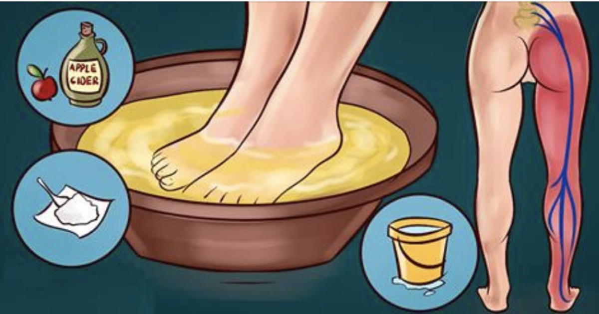 נסו את הטריק הזה ותגידו ביי ביי לנצח מכאב סכיאטי!