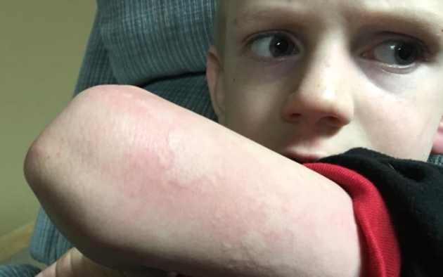 אחות מזהירה לגבי סימפטום חדש לשפעת שרוב ההורים מעולם לא ראו