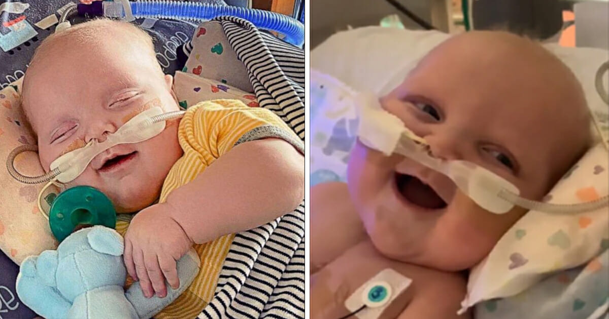 תינוק ששרד שני ניתוחי לב פתוחים חייך לראשונה בחייו בבית החולים וכבש את ליבו של האינטרנט