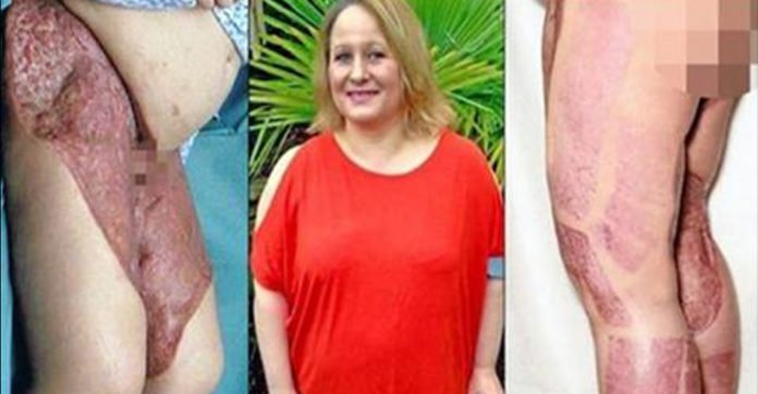 אמא כמעט איבדה את רגליה שהרקיבו כתוצאה מהרגל שכיח שיש לכל הבנות