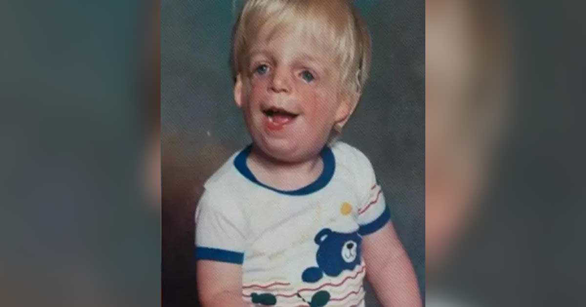 תינוק ננטש על ידי ההורים שלו בגלל העיוות בפנים שלו, עכשיו תסתכלו טוב 30 שנה אחר כך