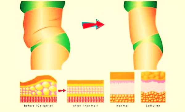 7 טיפים מדעיים שיעזרו לכם להיפטר מהשומן הבטני במהירות שיא