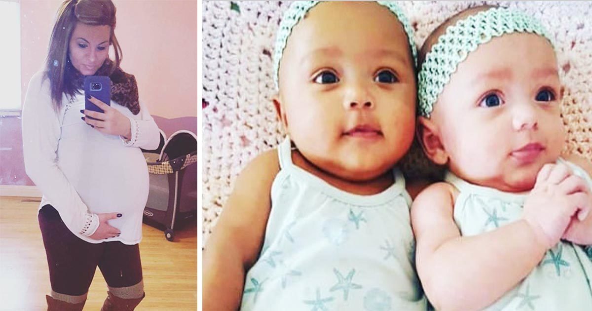 אמא ילדה תאומות – אז גילתה שהתינוקות שלה כל כך ייחודיות שהן אחד ממיליון