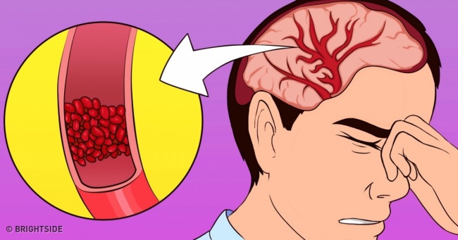 אם אתם סובלים לעתים קרובות מכאבי ראש, אינסומניה וחוסר אנרגיה – התחילו לצרוך את הויטמינים האלה