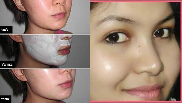 השתמשו במסכה הטבעית הזו 3 לילות ברציפות – והעור שלכן יהיה נקי, חלק ומלא ברק
