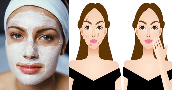 נסו את מסכת הפנים הטבעית הזו שתחזיר לעור הפנים שלכן את הזוהר המקורי שלו